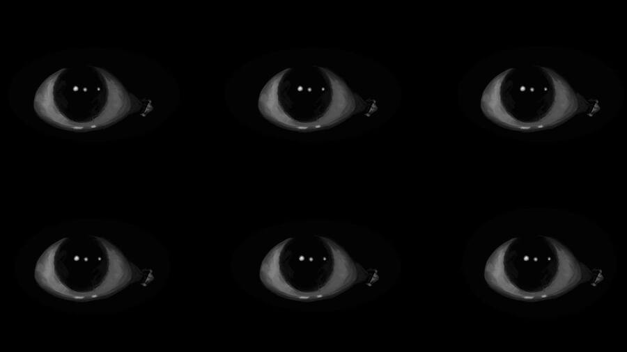 Sleep paralysis
