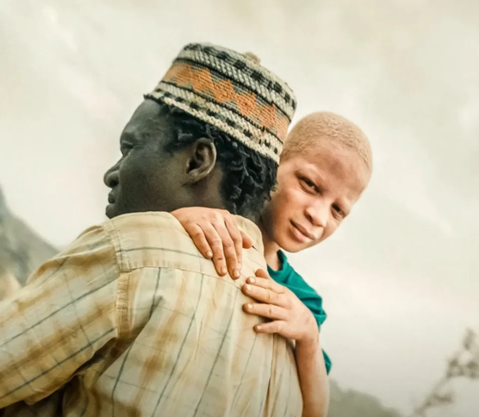 The Boy with White Skin
