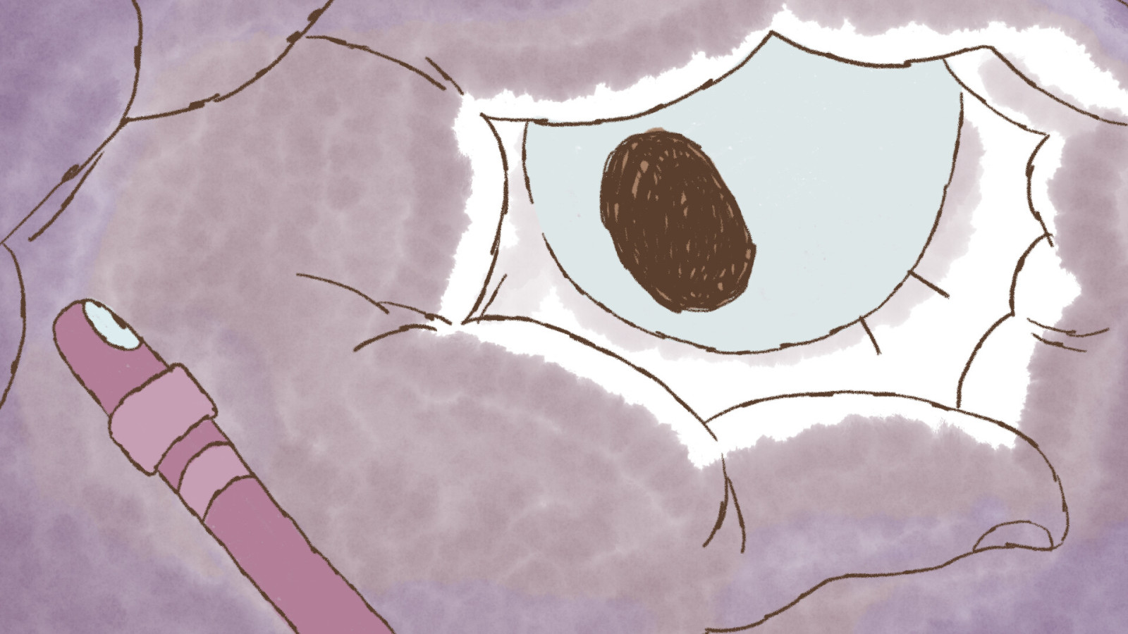 About the worm and the girl