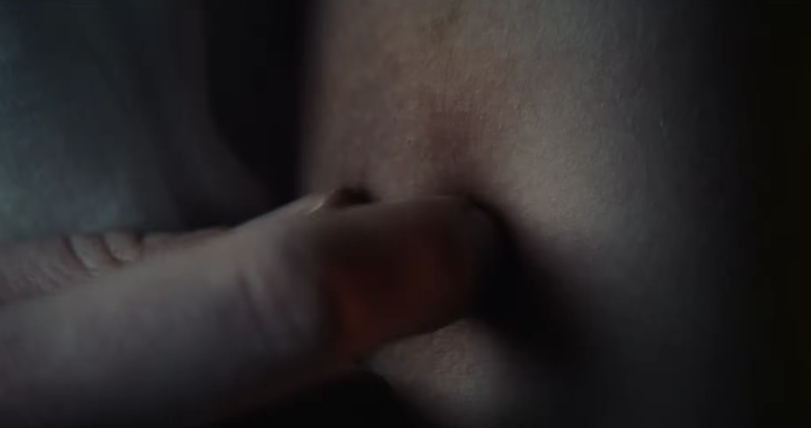 Original Skin