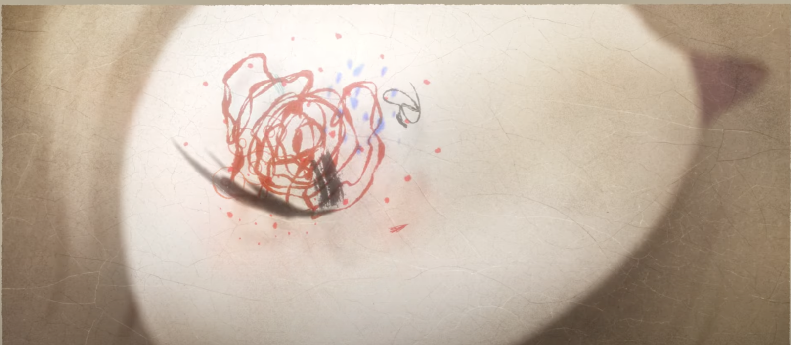The Undying Pain of Existence