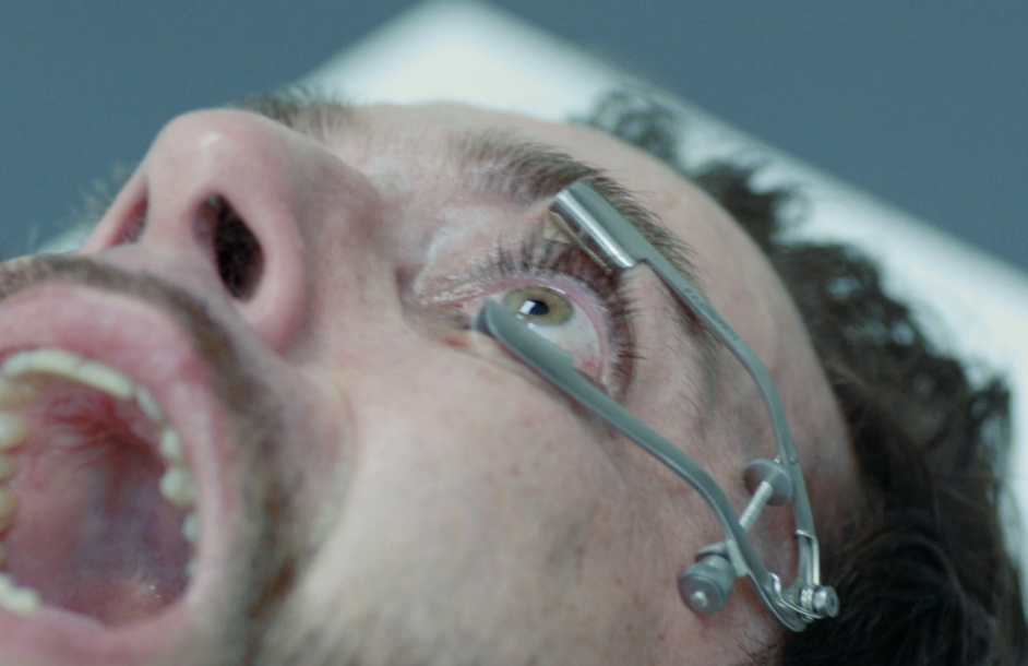 The Procedure