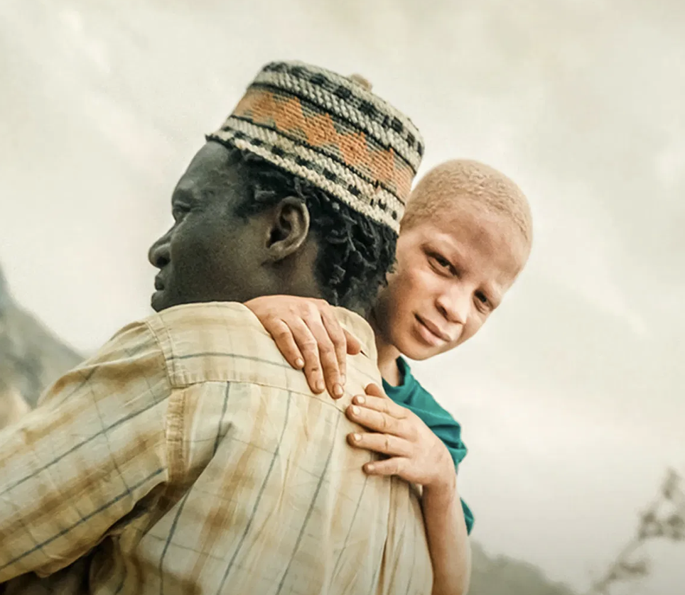 The Boy with White Skin