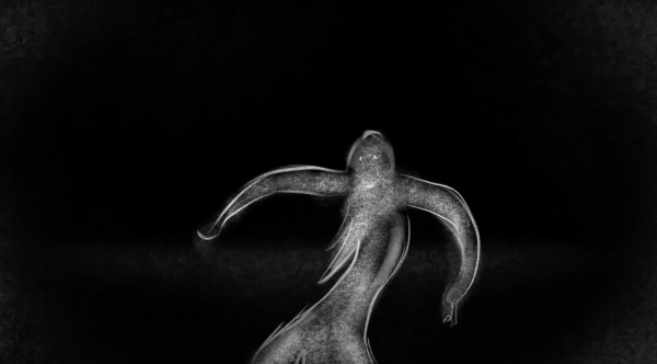 Amygdala