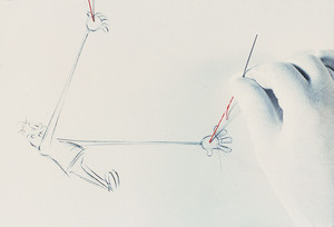 Manipulation