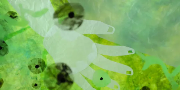 HAG