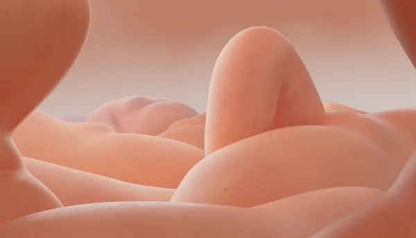 Wet