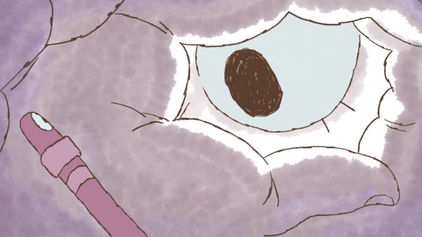 About the worm and the girl