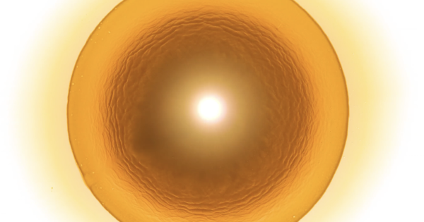 Stellar Iris
