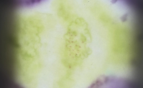 Plankton α